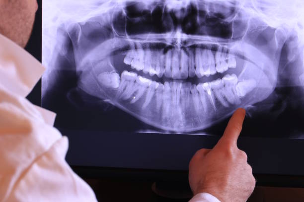 Best Weekend Emergency Dentist in Morgantown, MS