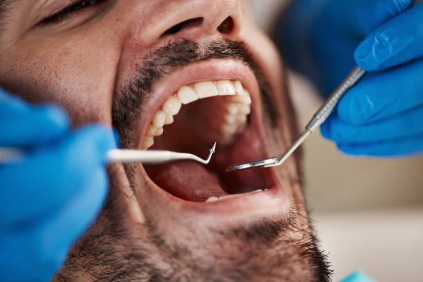 Best After-Hours Dental Trauma Care in Morgantown, MS