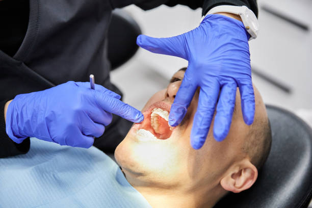 Best Emergency Treatment for Dental Infections or Abscesses in Morgantown, MS
