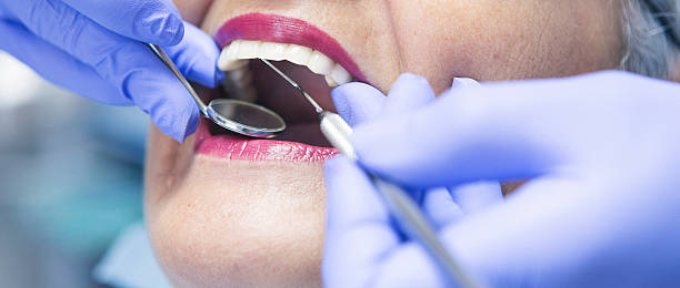 Best Emergency Treatment for Dental Infections or Abscesses in Morgantown, MS